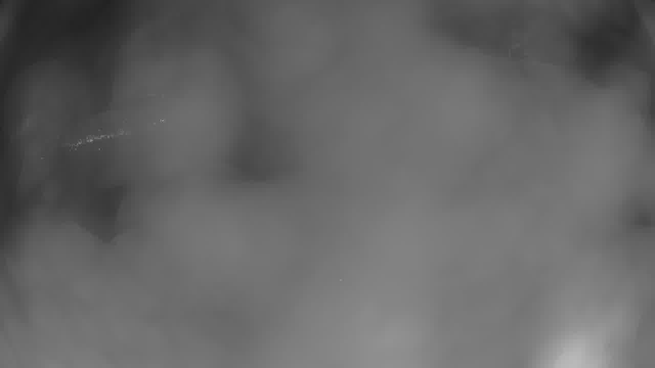 Breckenridge Peak 7 snow cam captured at 5 October 2026 at 10:03 pm GMT-6
